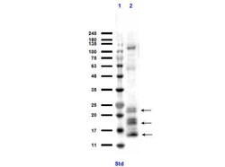 Ngp Polyclonal Antibody, Rockland 100 &mu;g | Buy Online | Rockland Immunochemicals | Fisher Scientific