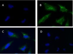 SQSTM1/p62 Polyclonal Antibody, Rockland 100 &mu;g; Unconjugated:Antibodies,