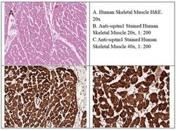 SQSTM1/p62 Polyclonal Antibody, Rockland 100 &mu;g; Unconjugated:Antibodies,