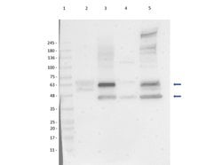 SQSTM1/p62 Polyclonal Antibody, Rockland 100 &mu;g; Unconjugated:Antibodies,