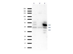 SQSTM1/p62 Polyclonal Antibody, Rockland 100 &mu;g; Unconjugated:Antibodies,