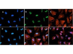 Acetyl-Histone H3 (Lys9, Lys14)Rabbit anti-C. elegans, Chicken, Drosophila,