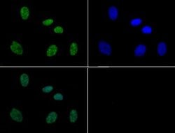 Phospho-Histone H3 (Ser10, Thr11)Rabbit anti-C. elegans, Chicken, Drosophila, Human, Mouse, Plant, Rat, Xenopus laevis, Polyclonal, Rockland 50 &mu;g | Buy Online | Rockland Immunochemicals | Fisher Scientific