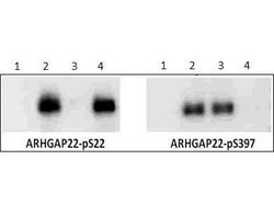 Phospho-Arhgap22 (Ser397)Rabbit anti-Human, Mouse, Rat, Polyclonal, Rockland