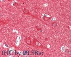Neuronal Calcium Sensor 1Rabbit anti-Human, Polyclonal, Rockland 100 &mu;g;