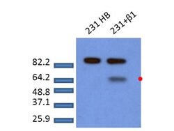 Phospho-SMAD2 (Ser465, Ser467) Polyclonal Antibody, Rockland 100 &mu;g;