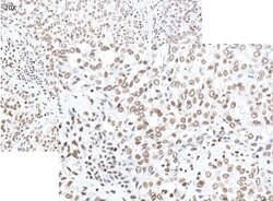 Smoothened Polyclonal Antibody, Rockland 100 &mu;g | Buy Online | Rockland Immunochemicals | Fisher Scientific