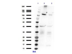 Smoothened Polyclonal Antibody, Rockland 100 &mu;g | Buy Online | Rockland Immunochemicals | Fisher Scientific