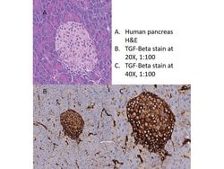 TGF beta Receptor 1 Polyclonal Antibody, Rockland 25 &mu;L; Unconjugated:Antibodies,