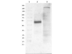 beta 1 Adrenergic Receptor Polyclonal Antibody, Rockland 100 &mu;g; Unconjugated:Antibodies,