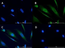 TBK1 Polyclonal Antibody, Rockland 25 &mu;L; Unconjugated:Antibodies, Polyclonal