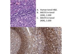 MeCP2 Polyclonal Antibody, Rockland:Antibodies:Primary Antibodies