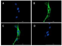 SNAI1 Polyclonal Antibody, Rockland 100 &mu;g; Unconjugated:Antibodies,