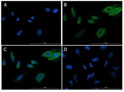 SNAI1 Polyclonal Antibody, Rockland 100 &mu;g; Unconjugated:Antibodies,