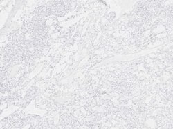 Scp3 Polyclonal Antibody, Rockland:Antibodies:Primary Antibodies
