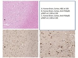 Phospho-PI 3 Kinase p85 alpha (Tyr607) Polyclonal Antibody, Rockland 100