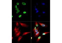 Acetyl-Histone H4 (Lys12)Rabbit anti-Human, Polyclonal, Rockland 50 μg;