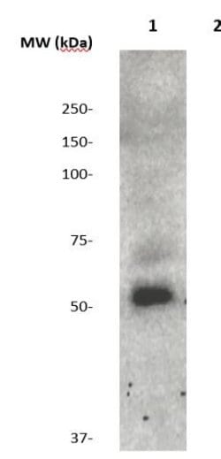SAPOSIN (PSAP) Polyclonal Antibody, Abbomax 100 &mu;g; Unconjugated:Antibodies,