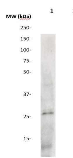 SOCS3 Polyclonal Antibody, Abbomax 100 &mu;g | Buy Online | Abbomax Inc | Fisher Scientific