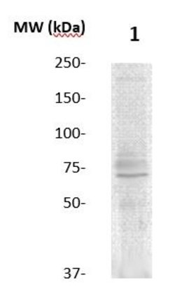 15-Lox-2 Polyclonal Antibody, Abbomax 100 &mu;g; Unconjugated:Antibodies,
