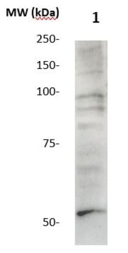 MMP-28 Polyclonal Antibody, Abbomax 100 &mu;g; Unconjugated:Antibodies,