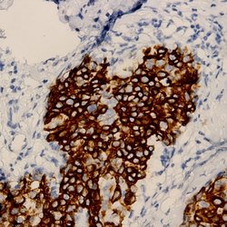 PSA Polyclonal Antibody, Abbomax 100 &mu;g | Buy Online | Abbomax Inc | Fisher Scientific