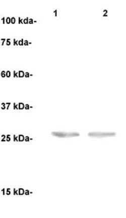 PSA Polyclonal Antibody, Abbomax 100 &mu;g | Buy Online | Abbomax Inc | Fisher Scientific
