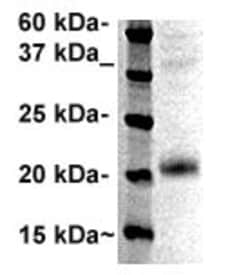 Casein (kappa) Polyclonal Antibody, Abbomax 100 &mu;g; Unconjugated:Antibodies,