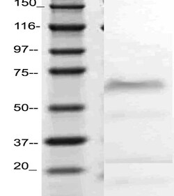 Selectin E Polyclonal Antibody, Abbomax 100 &mu;g; Unconjugated:Antibodies,