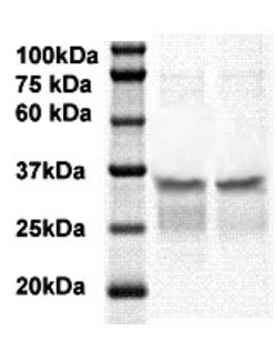 PSA/Kallikrein 3 Polyclonal Antibody, Abbomax 100 &mu;g; Unconjugated:Antibodies,