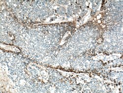 TGFBI / BIGH3 Mouse anti-Human, Mouse, Clone: 3E11D11, Proteintech:Antibodies:Primary
