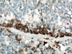 TGFBI / BIGH3 Mouse anti-Human, Mouse, Clone: 3E11D11, Proteintech:Antibodies:Primary