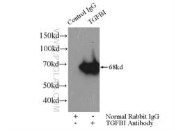 TGFBI / BIGH3 Mouse anti-Human, Mouse, Clone: 3E11D11, Proteintech:Antibodies:Primary