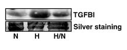 TGFBI / BIGH3 Mouse anti-Human, Mouse, Clone: 3E11D11, Proteintech:Antibodies:Primary