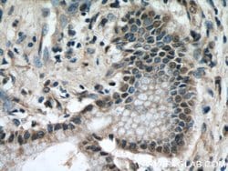KEAP1 Mouse anti-Human, Rat, Clone: 4G10H9, Proteintech:Antibodies:Primary