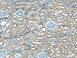 KEAP1 Mouse anti-Human, Rat, Clone: 4G10H9, Proteintech:Antibodies:Primary