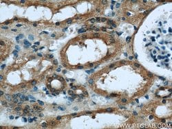 KEAP1 Mouse anti-Human, Rat, Clone: 4G10H9, Proteintech:Antibodies:Primary