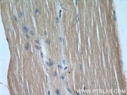 KEAP1 Mouse anti-Human, Rat, Clone: 4G10H9, Proteintech:Antibodies:Primary