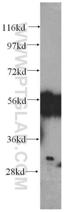 FKBPL Mouse anti-Human, Mouse, Clone: 5D9A9, Proteintech 20 &mu;L; Unconjugated:Antibodies,