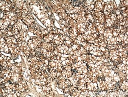 MME/CD10 Mouse anti-Human, Mouse, Porcine, Clone: 4B9D9, Proteintech 150