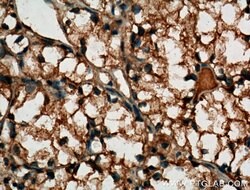 MME/CD10 Mouse anti-Human, Mouse, Porcine, Clone: 4B9D9, Proteintech 150