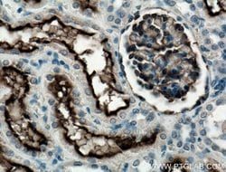 MME/CD10 Mouse anti-Human, Mouse, Porcine, Clone: 4B9D9, Proteintech 150