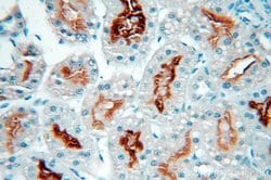 MME/CD10 Mouse anti-Human, Mouse, Porcine, Clone: 4B9D9, Proteintech 150