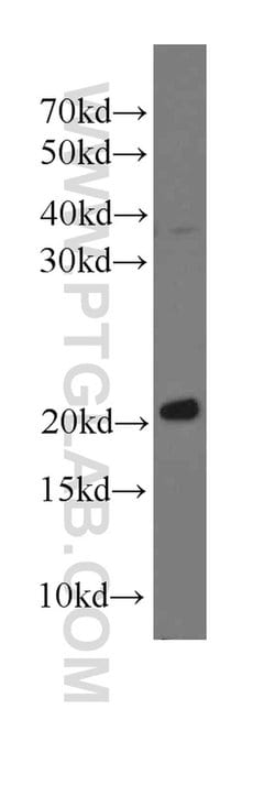 Transgelin 2 Mouse anti-Human, Mouse, Clone: 2E5G1, Proteintech 20 &mu;L | Buy Online | Proteintech | Fisher Scientific