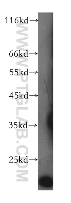 Transgelin 2 Mouse anti-Human, Mouse, Clone: 2E5G1, Proteintech 20 &mu;L | Buy Online | Proteintech | Fisher Scientific
