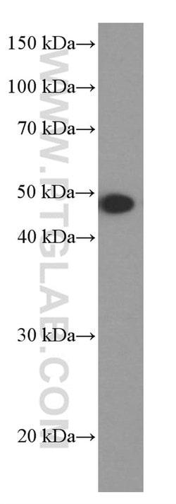 MAGEA3 Mouse anti-Human, Mouse, Porcine, Rat, Clone: 1A9F3, Proteintech