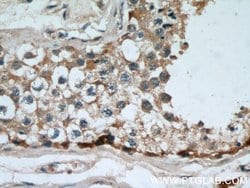 MAGEA3 Mouse anti-Human, Mouse, Porcine, Rat, Clone: 1A9F3, Proteintech