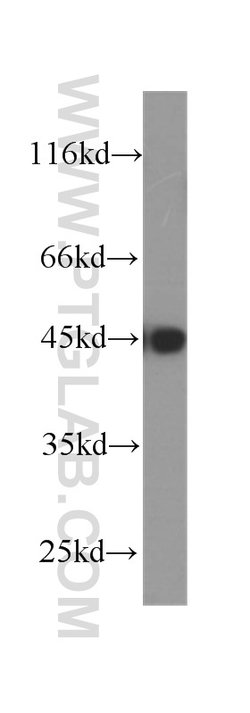 MAGEA3 Mouse anti-Human, Mouse, Porcine, Rat, Clone: 1A9F3, Proteintech