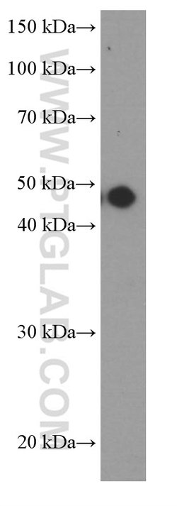 MAGEA3 Mouse anti-Human, Mouse, Porcine, Rat, Clone: 1A9F3, Proteintech