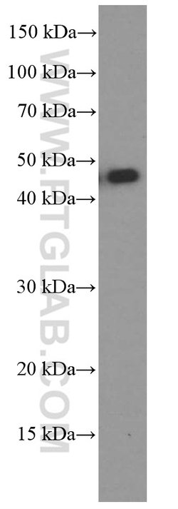 MAGEA3 Mouse anti-Human, Mouse, Porcine, Rat, Clone: 1A9F3, Proteintech